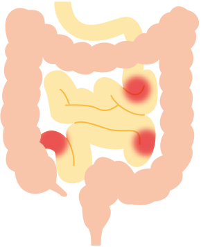小腸型のイラスト